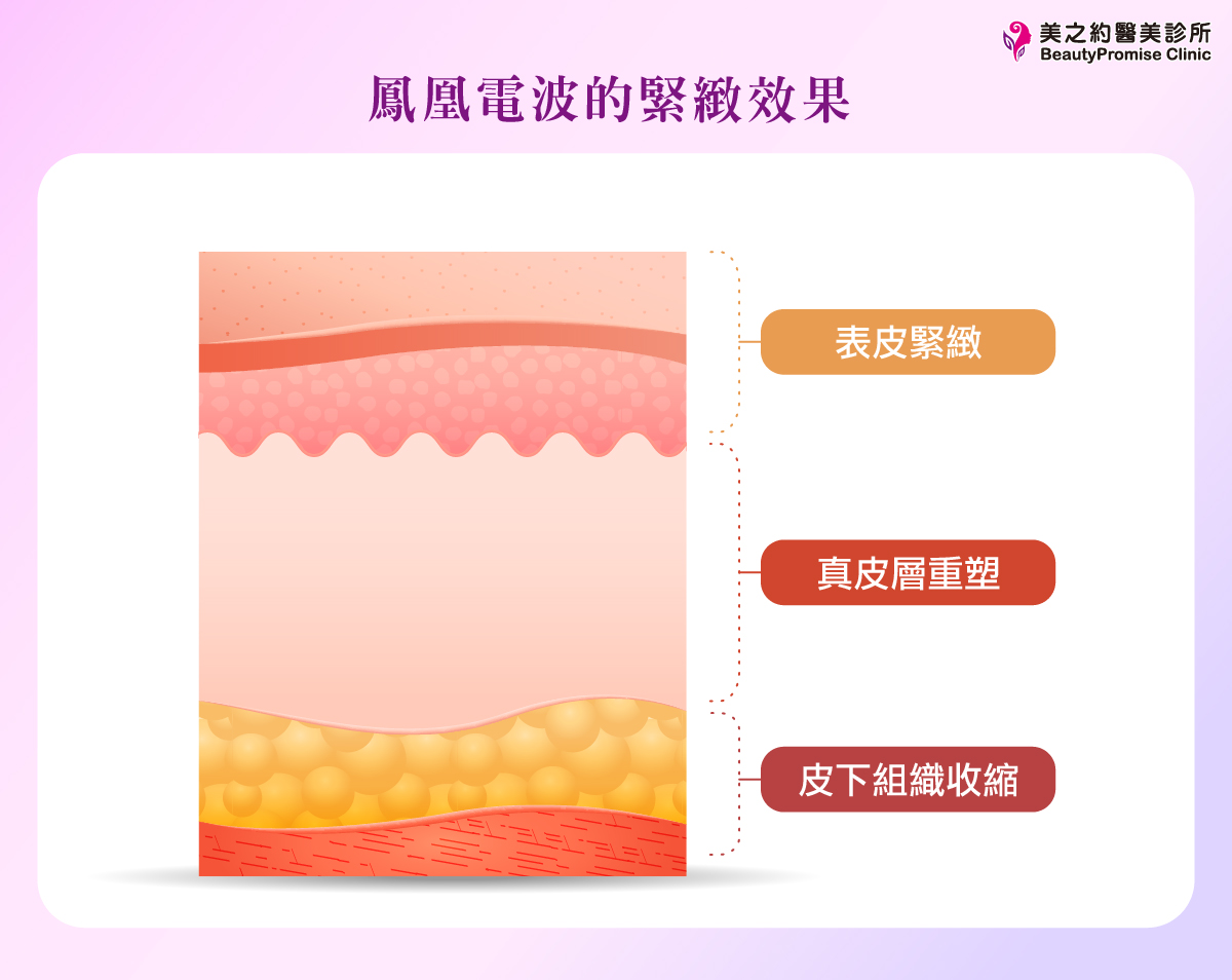 鳳凰電波的三重效果