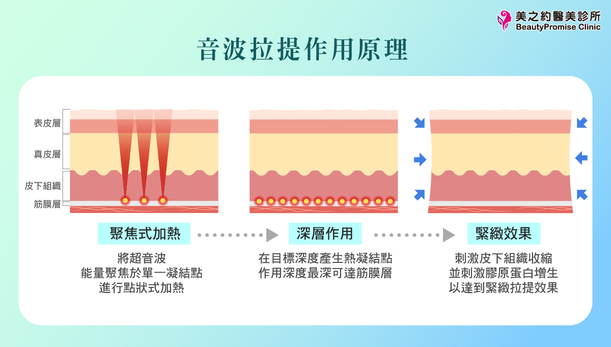 音波拉提作用原理