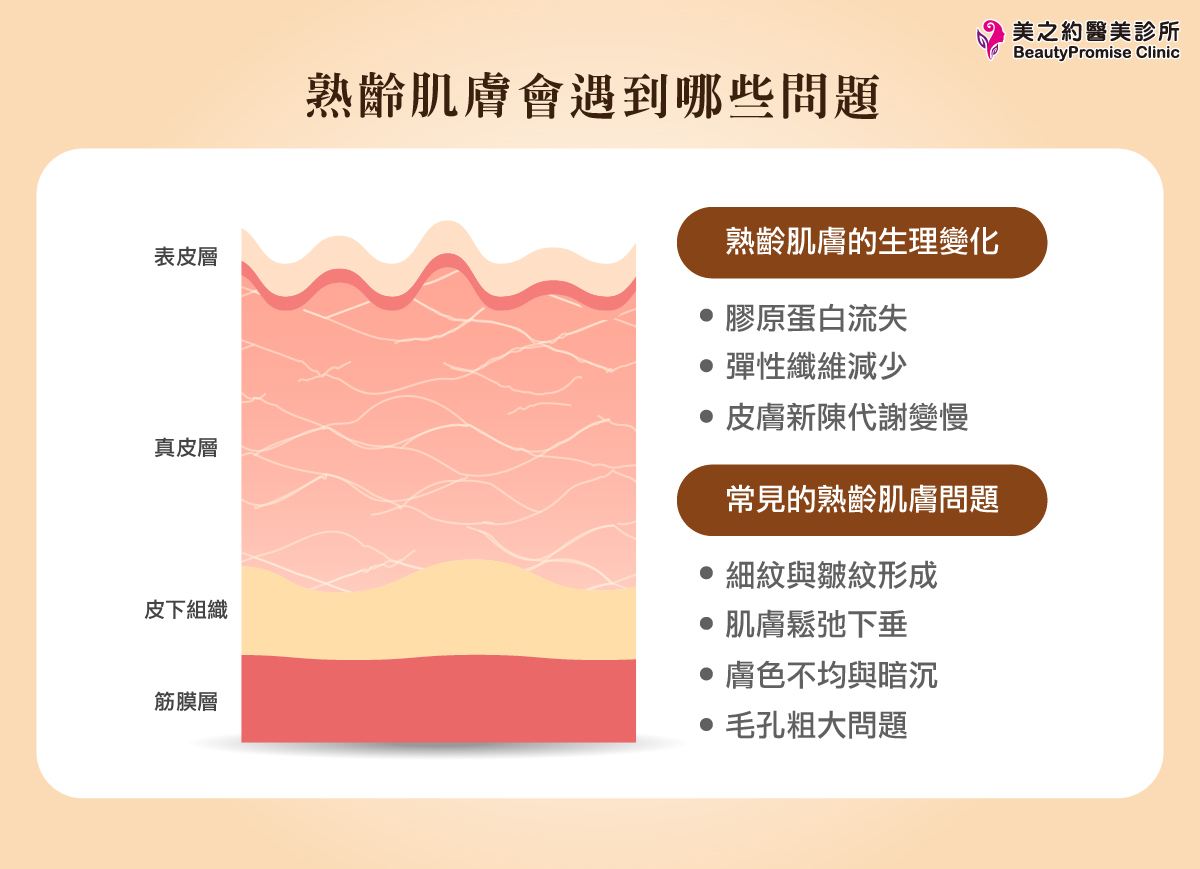 美之約醫美整所整理熟齡肌的肌膚問題