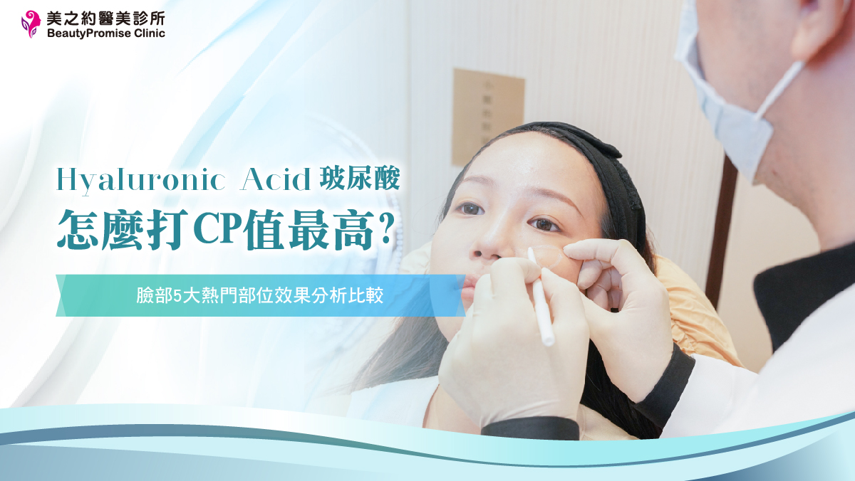 玻尿酸怎麼打CP值最高？臉部5大熱門部位效果分析比較