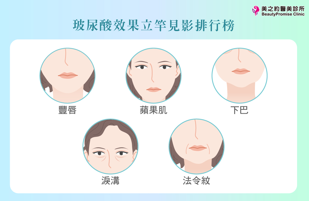 美之約診所整理玻尿酸效果立即出現的5個部位