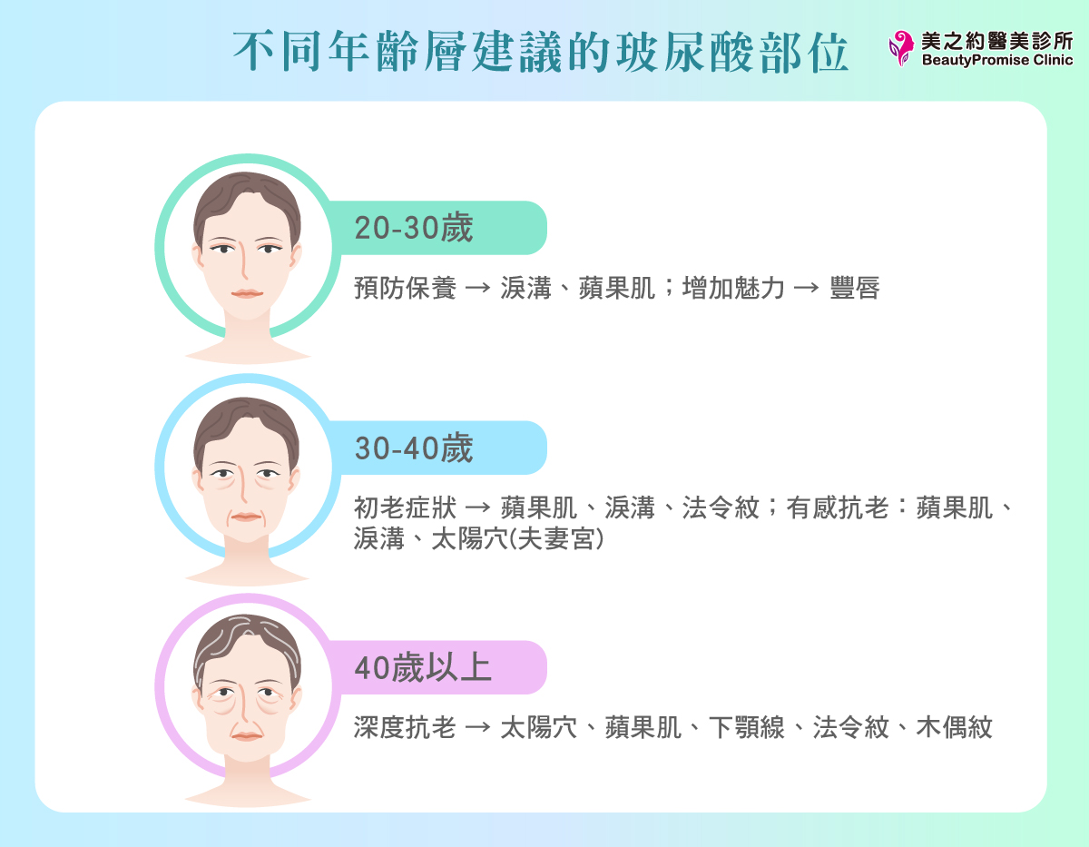 美之約診所整理不同年齡層建議的玻尿酸部位