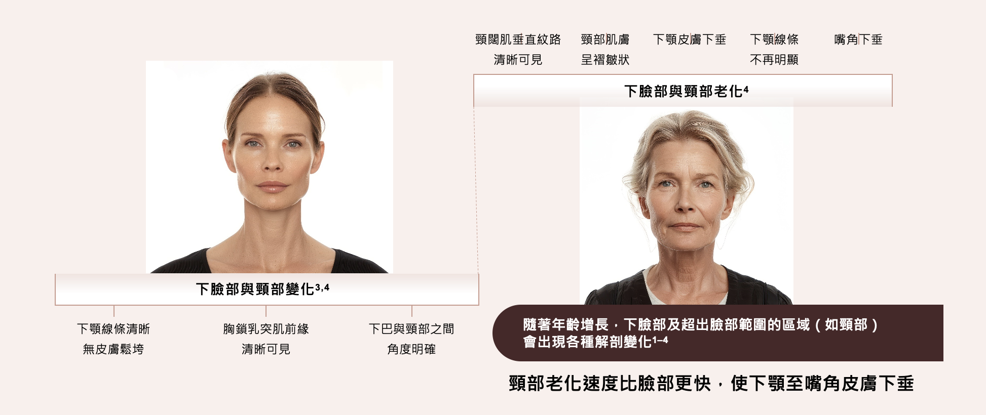 研究發現，頸部老化速度比臉部更快，更會連帶影響臉部皮膚下垂