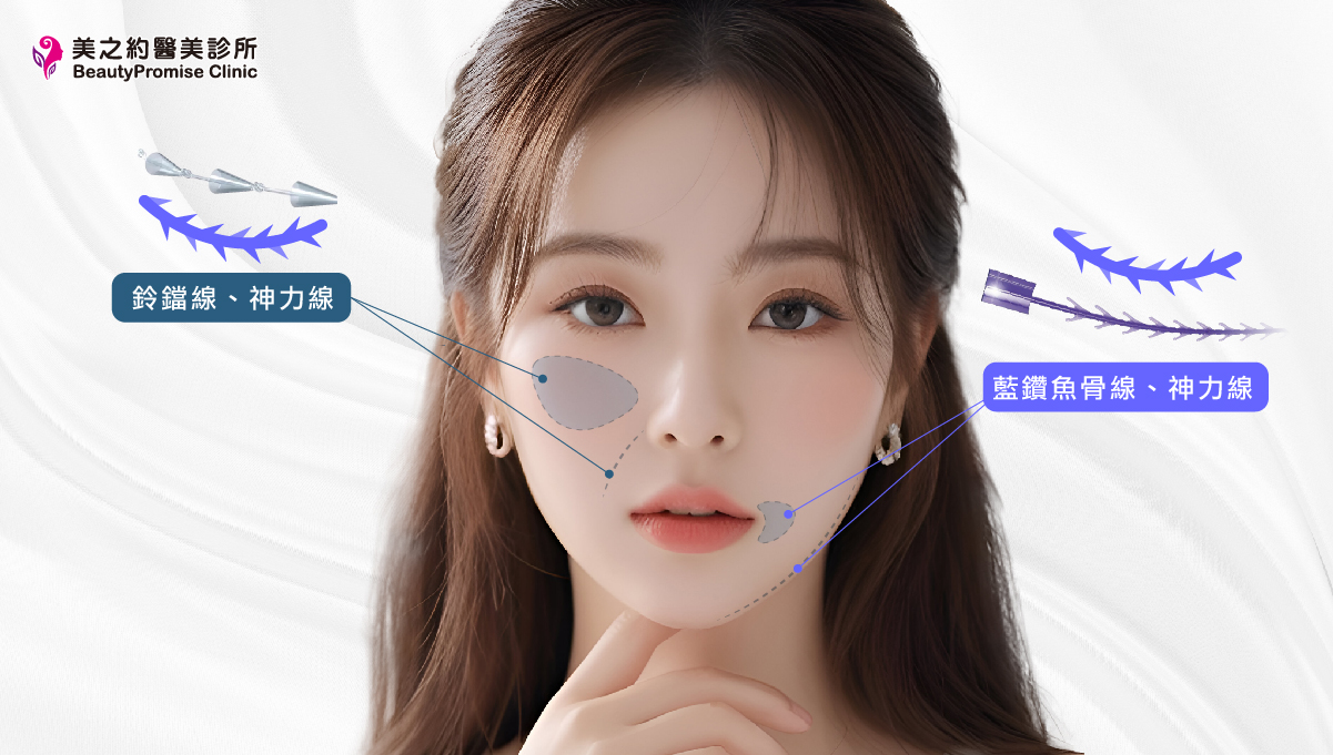 不同臉部位置所對應的埋線拉提線材