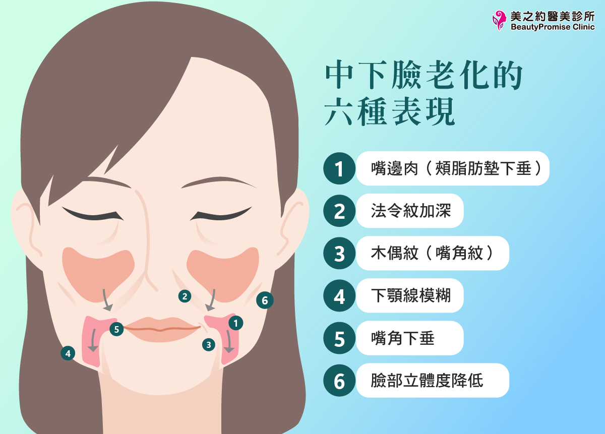 中下臉老化的 6 大視覺表現