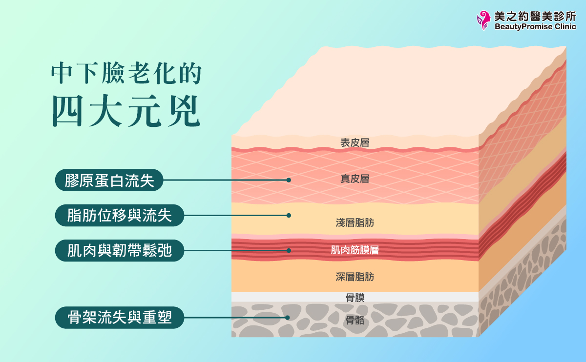 中下臉老化的4大元兇