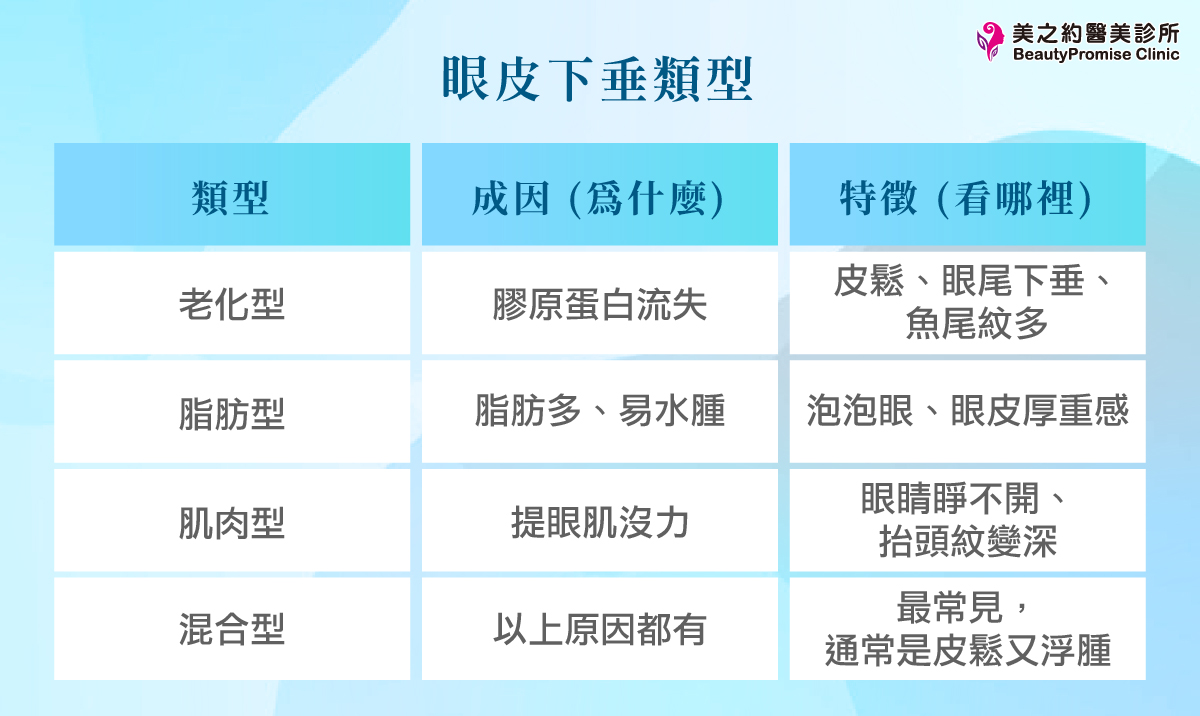 眼皮下垂類型