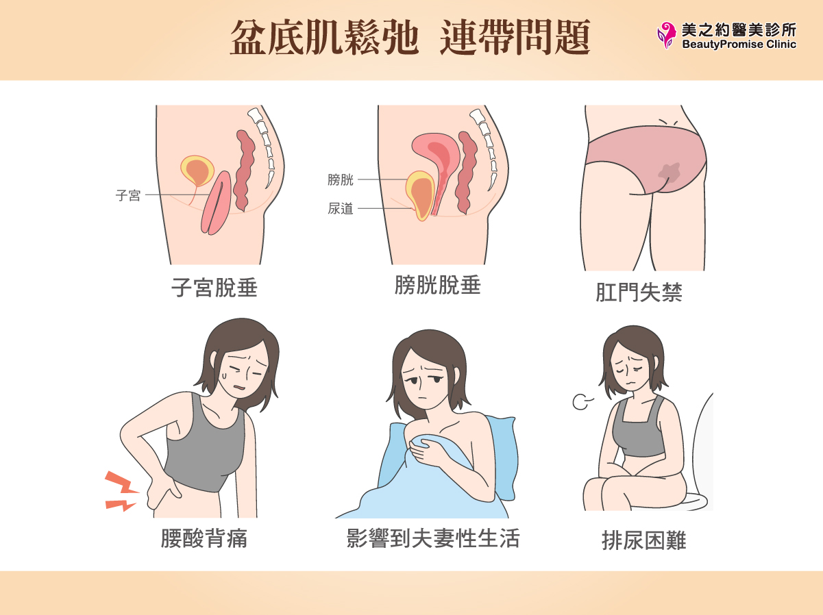 許多女性在產後會感覺到身體有些「不對勁」，原本緊實的曲線似乎隨著寶寶的出生而變得鬆弛