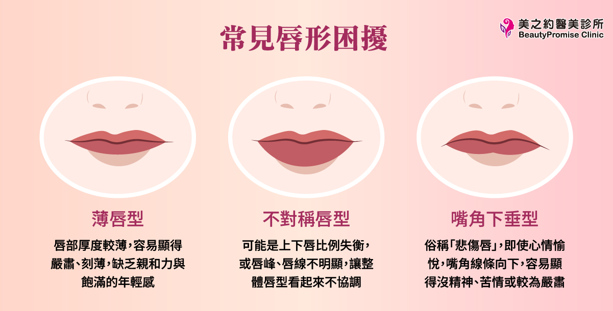 常見唇形困擾