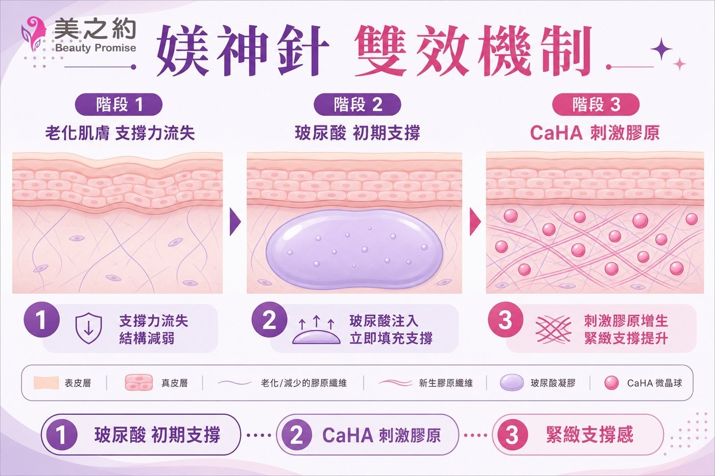 媄神針 HArmonyCa 雙效機制衛教示意圖：階段1 老化肌膚支撐力流失、階段2 玻尿酸提供初期即時支撐、階段3 CaHA 刺激膠原蛋白新生帶來緊緻支撐，標示表皮層與真皮層