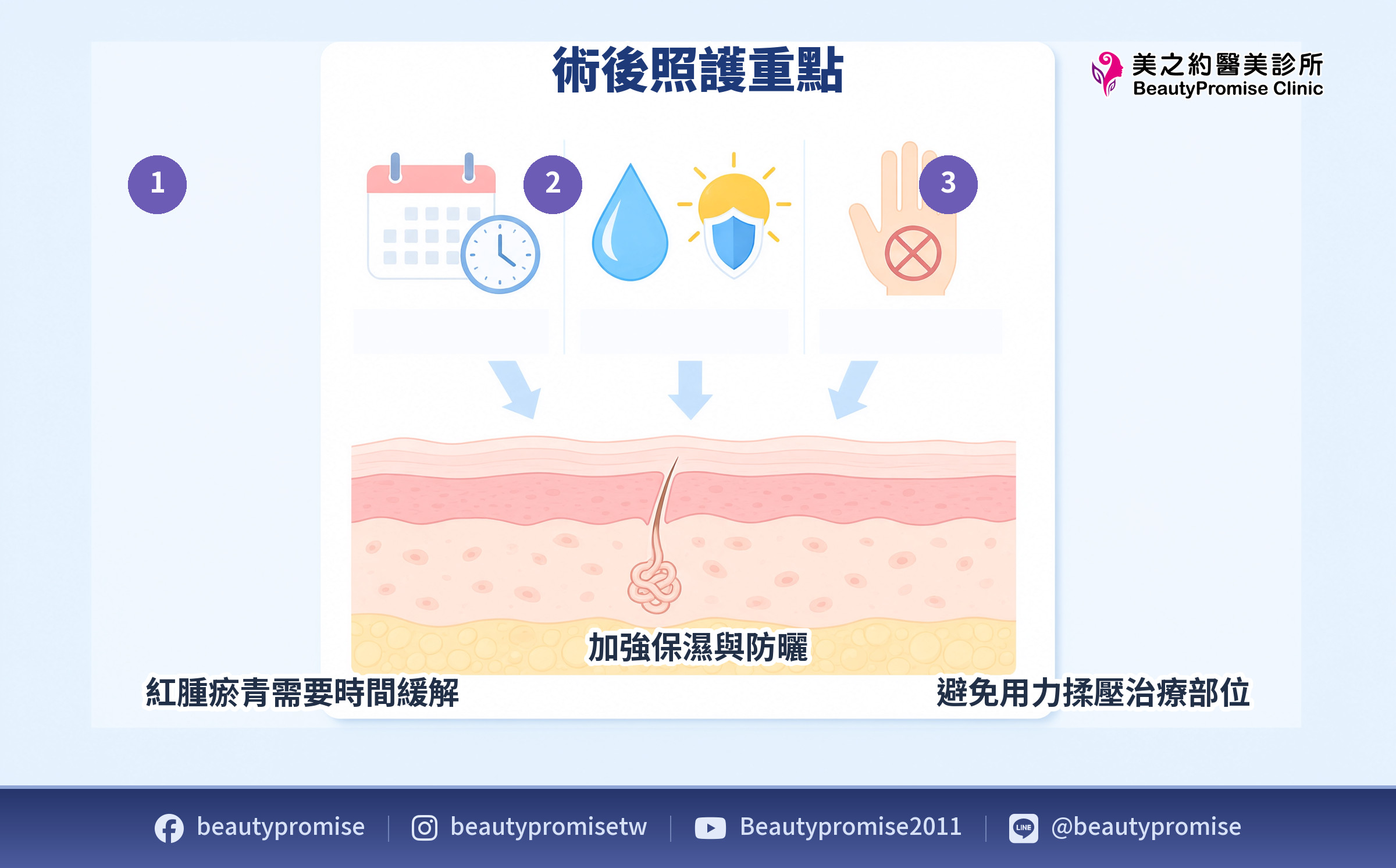 術後照護三項重點示意圖