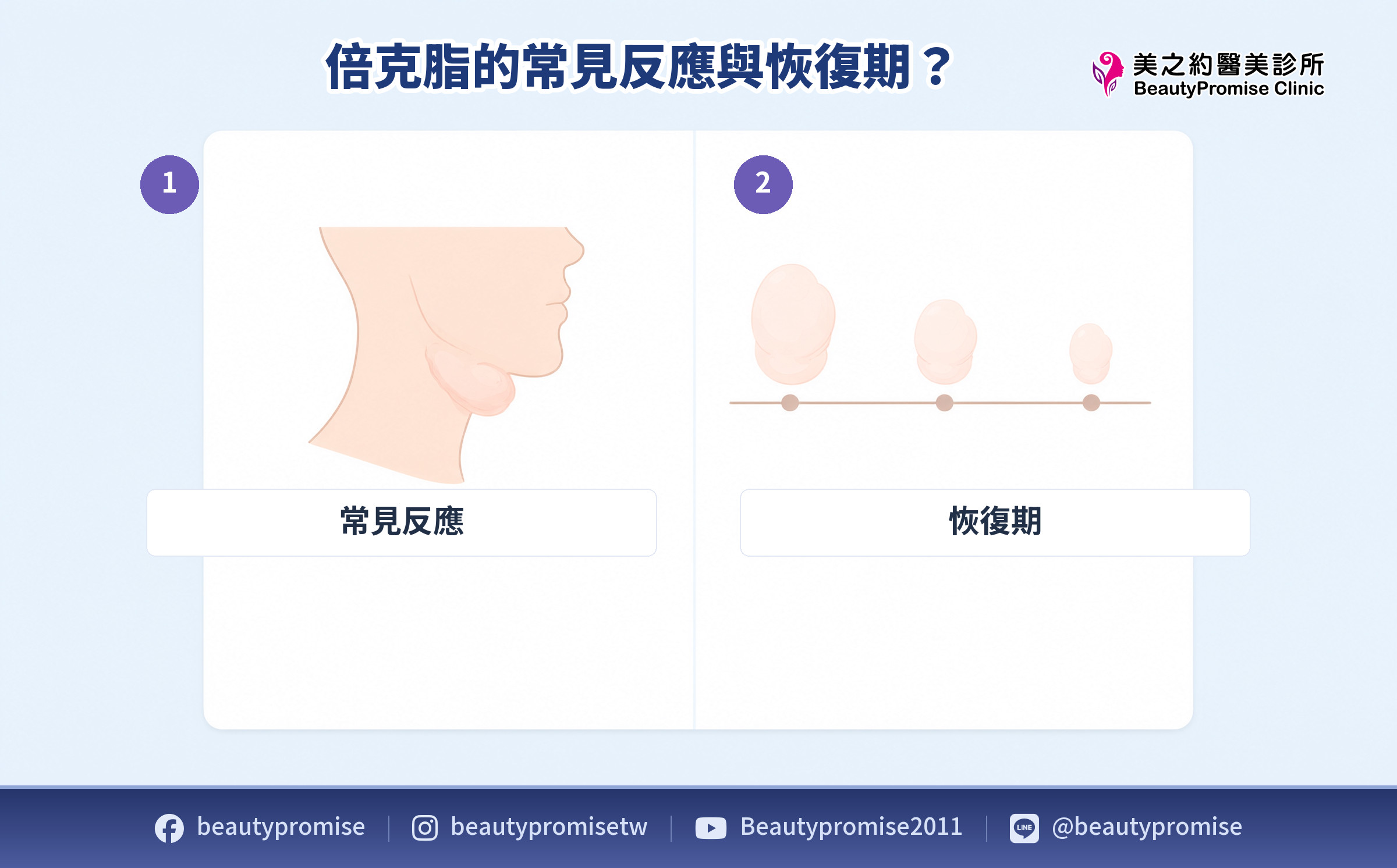 注射後常見腫脹反應與恢復時間變化的示意圖