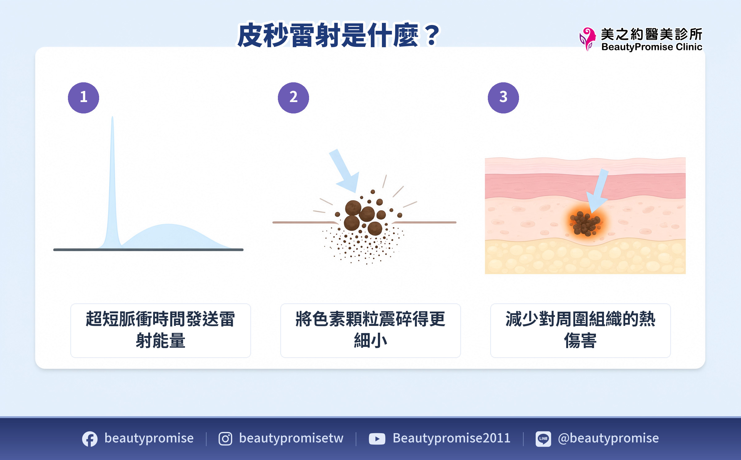 皮秒雷射以超短脈衝震碎色素顆粒並減少周圍熱傷害的原理示意圖