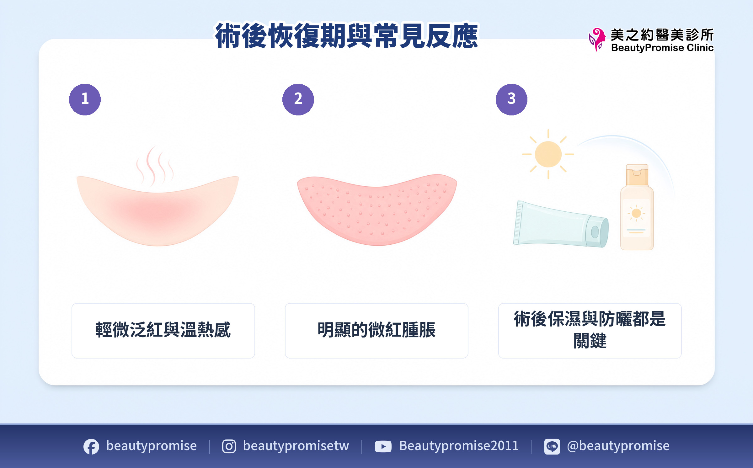 一般手具與蜂巢透鏡治療後的反應差異,以及保濕防曬照護重點的示意圖