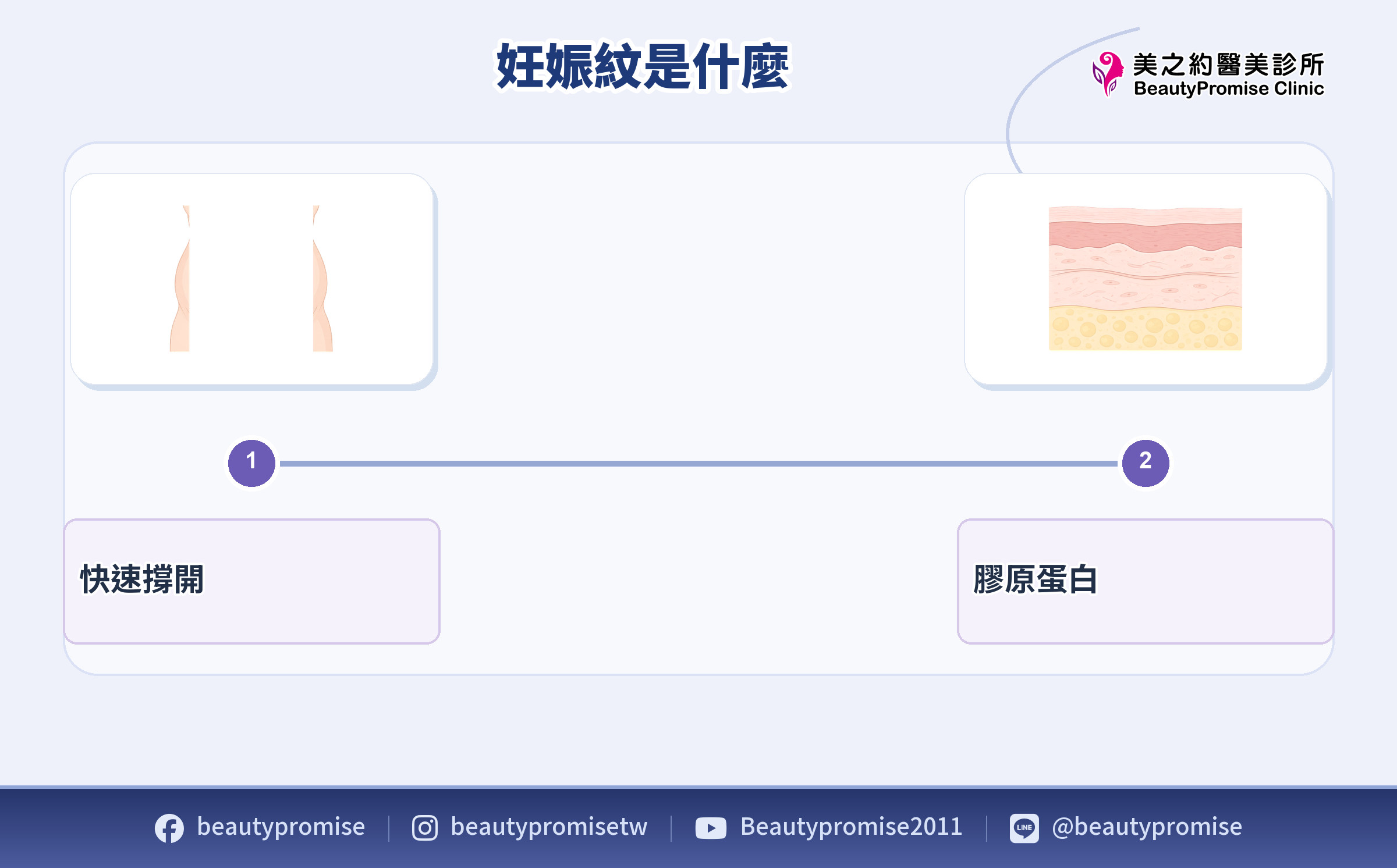 皮膚快速撐開與真皮層膠原蛋白變化的機制示意