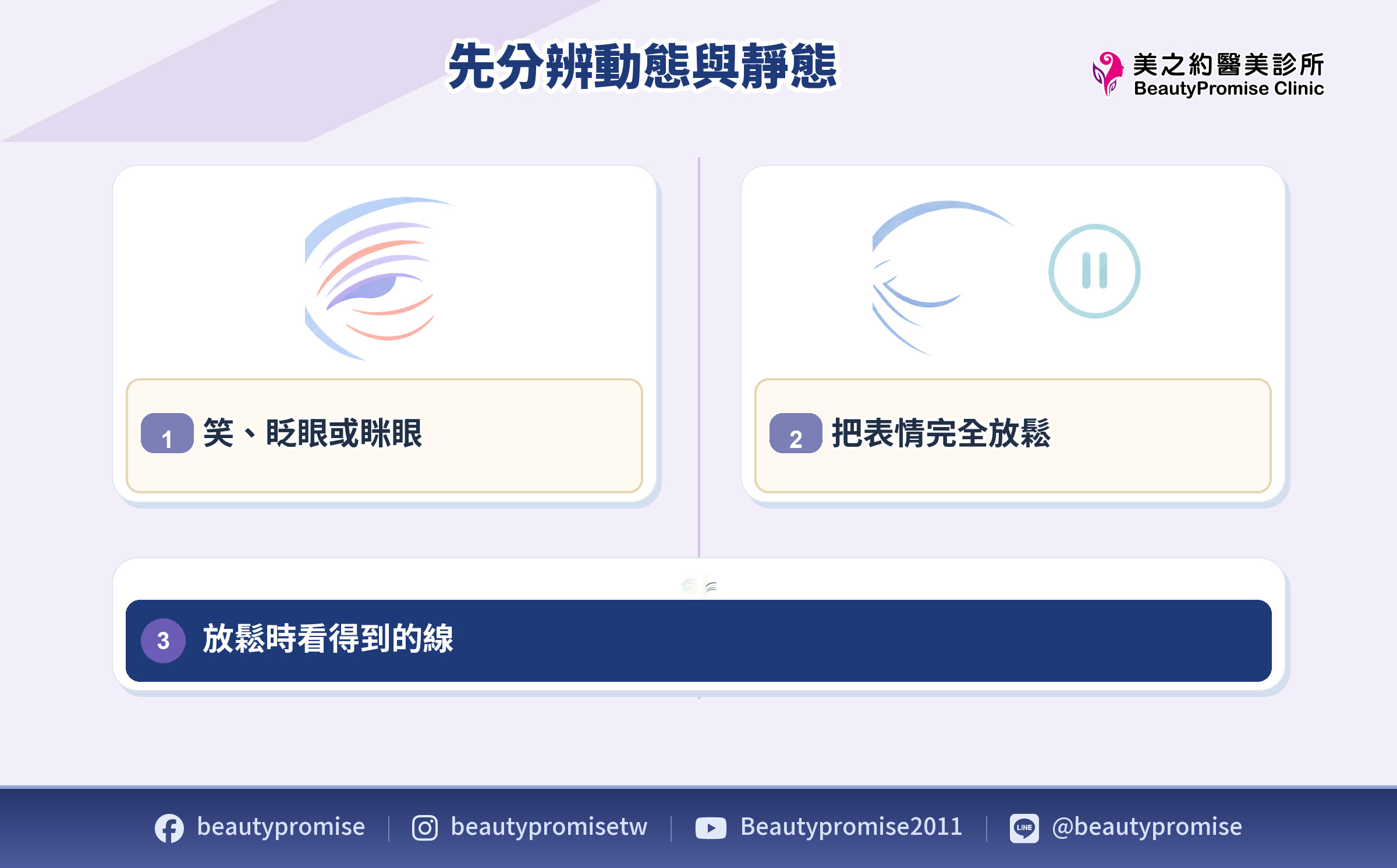 魚尾紋動態紋與靜態紋分辨示意