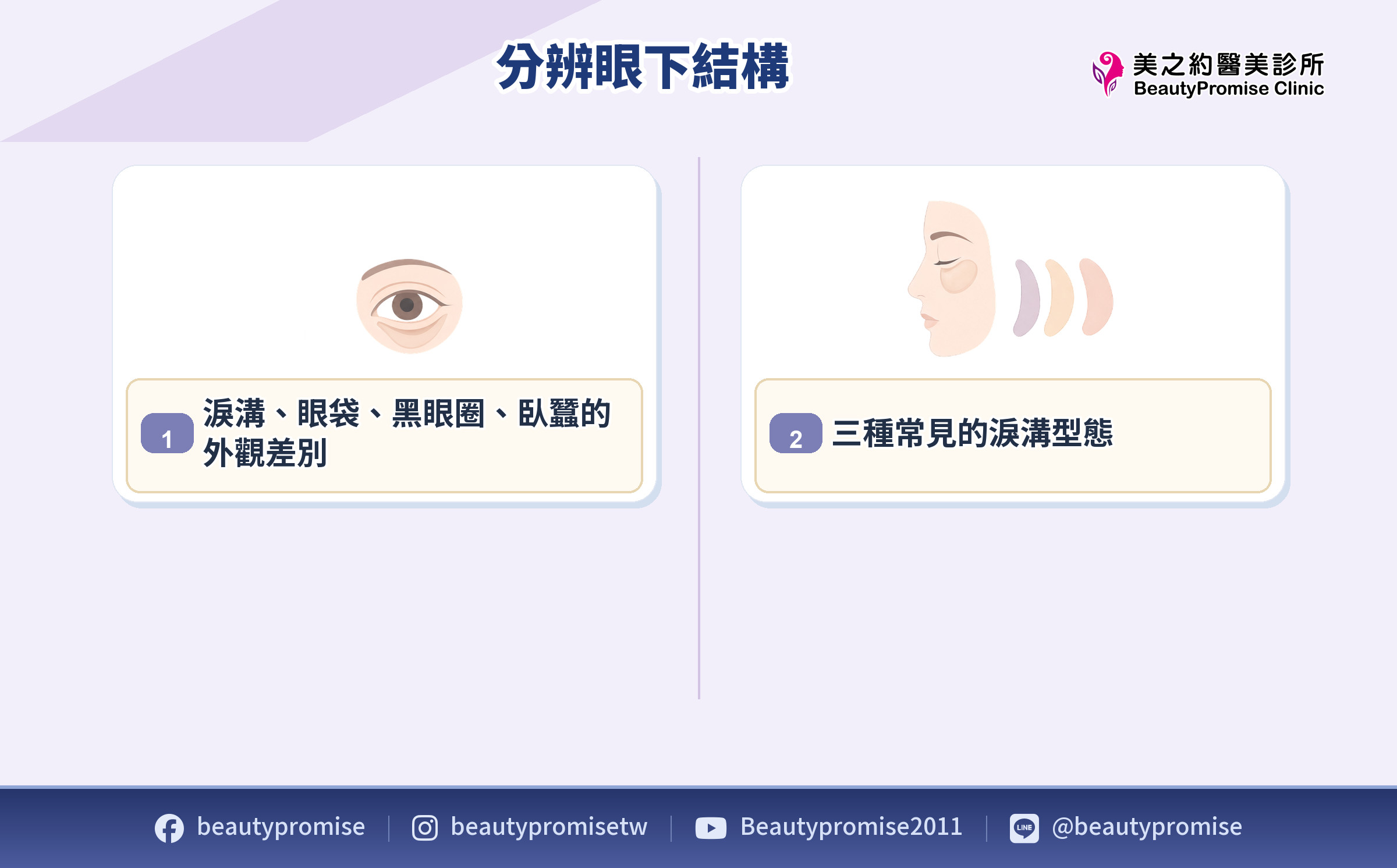 凹陷、眼袋、黑眼圈與臥蠶的外觀差異示意