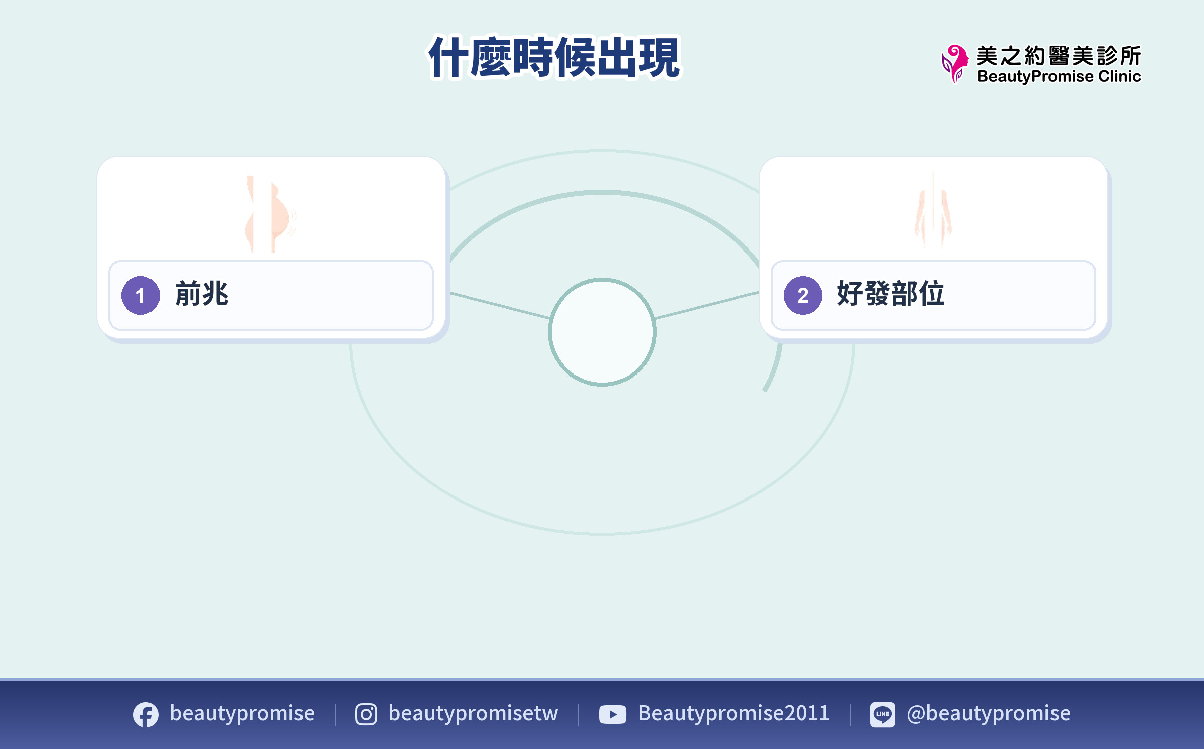 妊娠紋前兆與常見好發部位的外觀示意