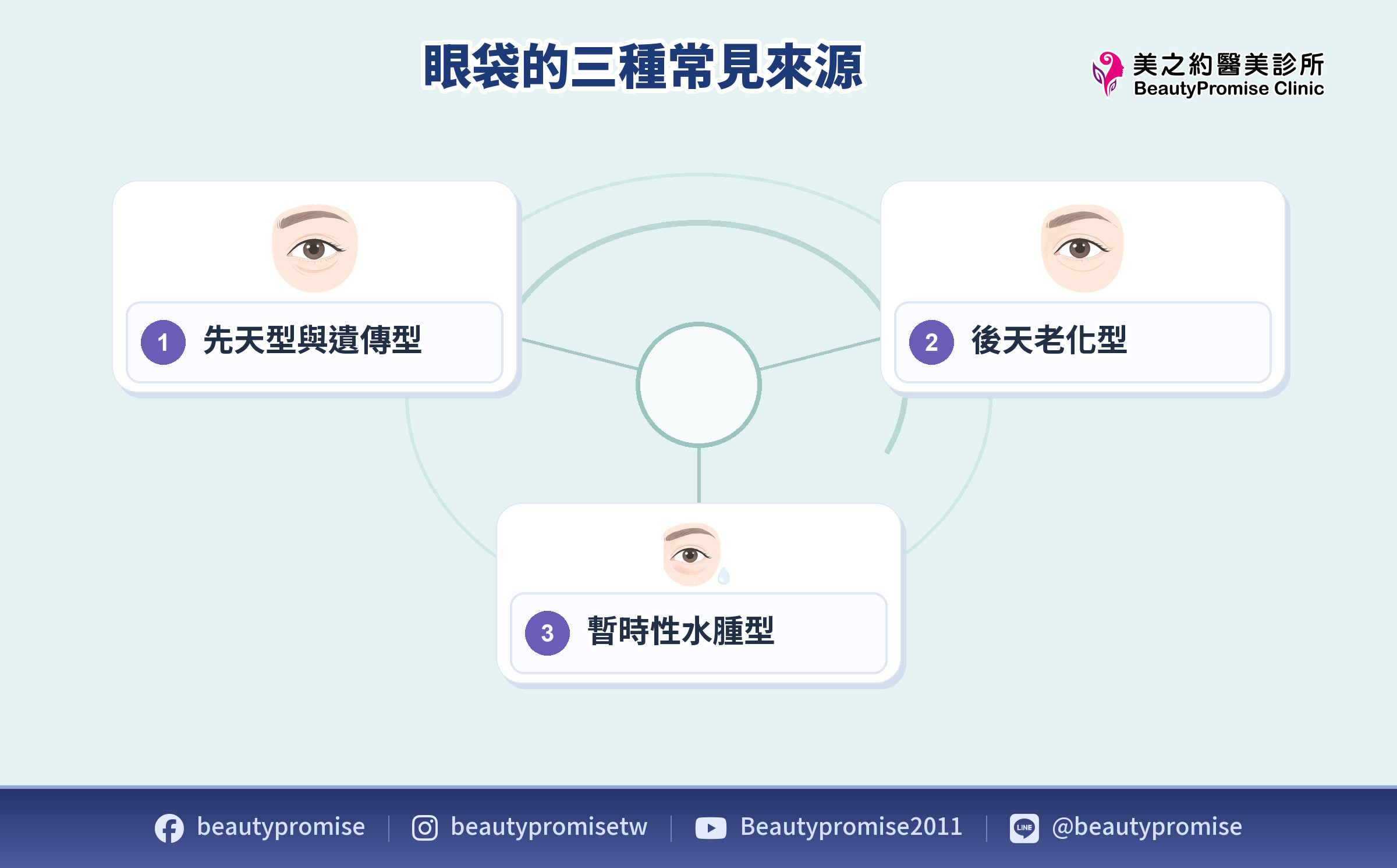 先天遺傳、後天老化鬆弛與暫時水腫的眼下外觀示意