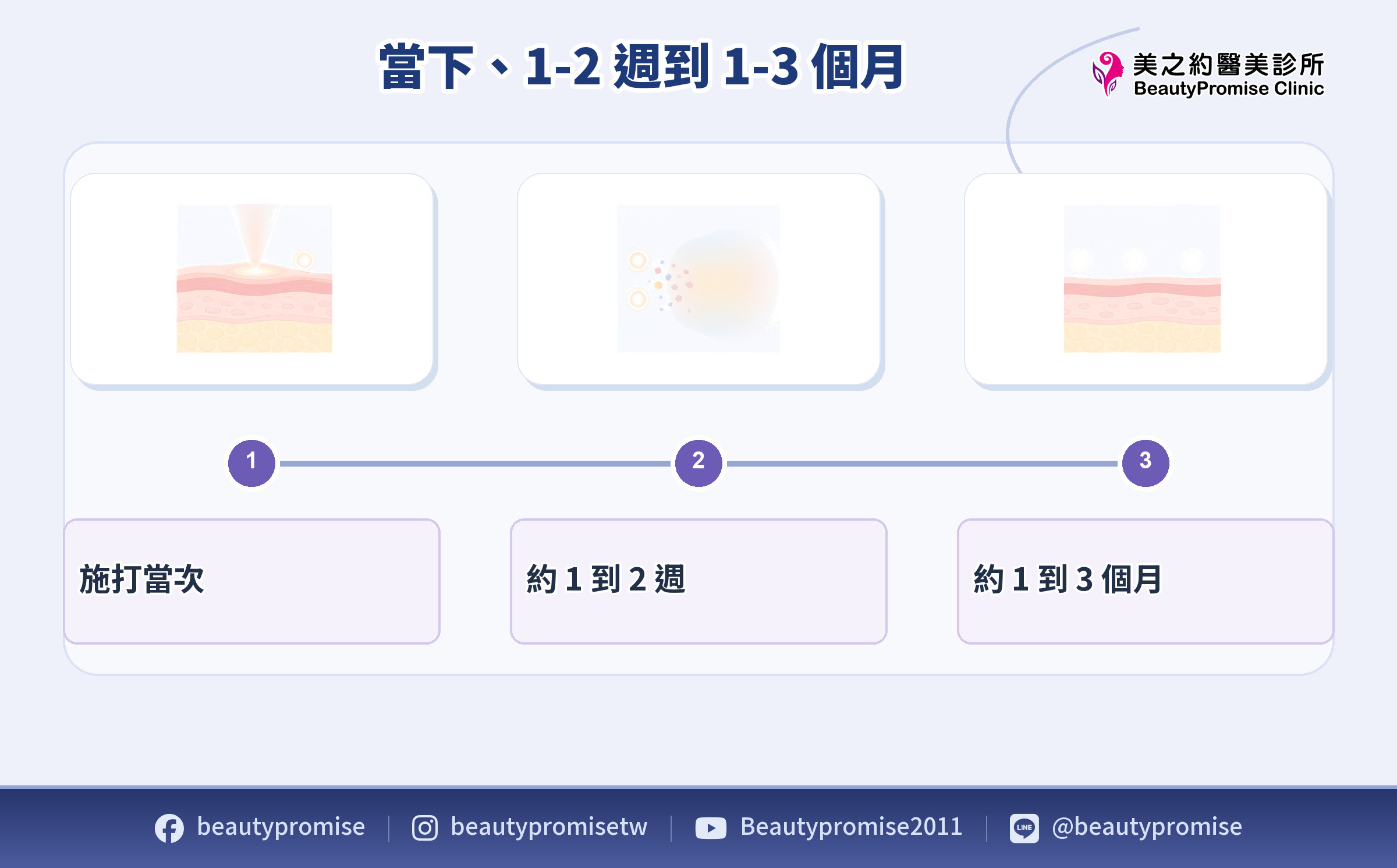 皮秒雷射從施打當次到一至三個月逐步觀察變化的時間軸示意