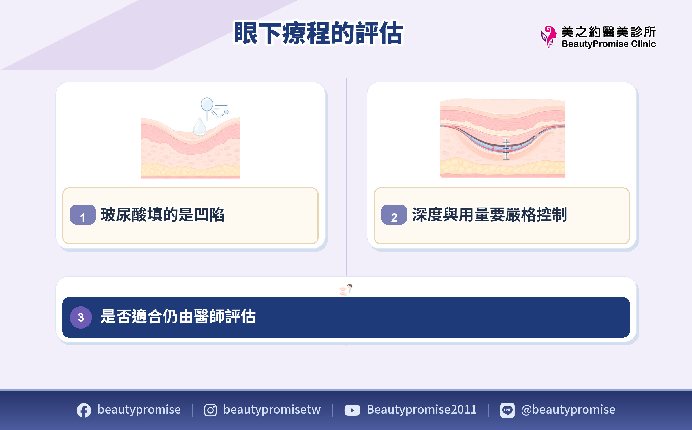眼下凹陷、肌肉與鬆弛分層評估及玻尿酸注射安全界線示意圖