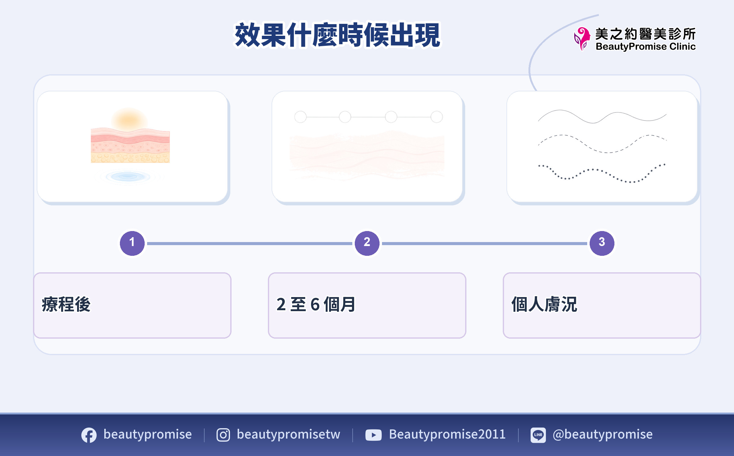鳳凰電波效果時間與個人膚況差異需納入預算判斷的示意