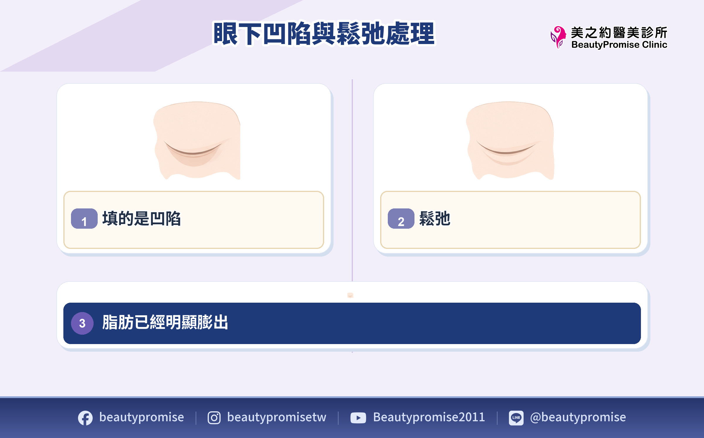 眼下凹陷、鬆弛與脂肪膨出的處理層次示意